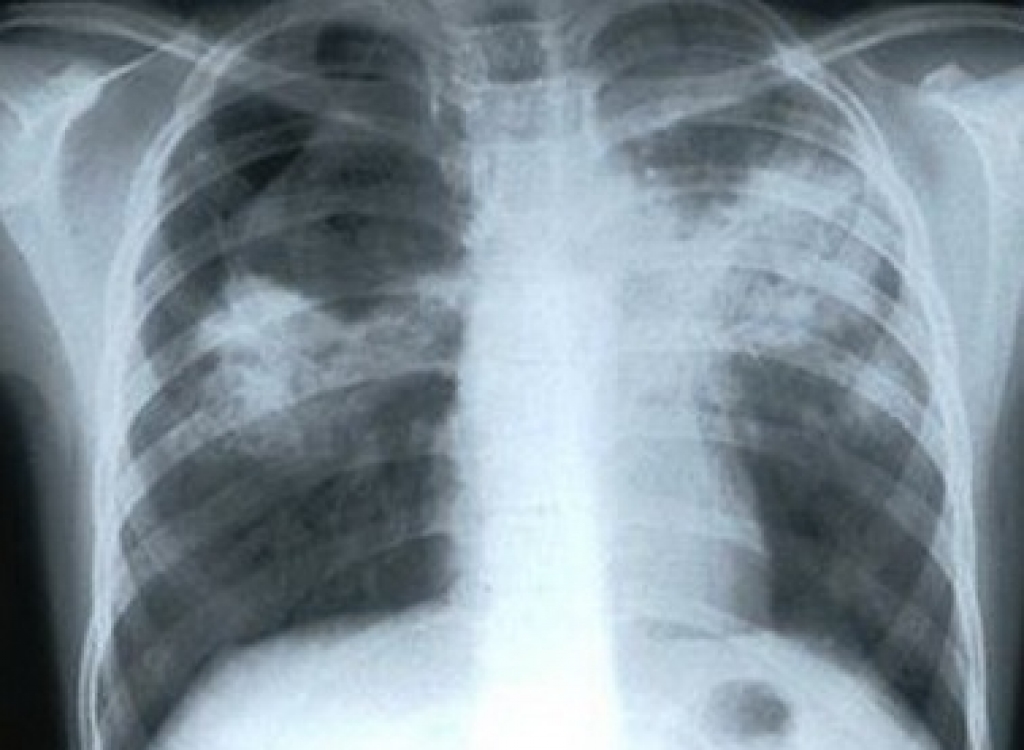 Attēlam ilustratīva nozīme.
Autors: no www.sieviesuklubs.lv