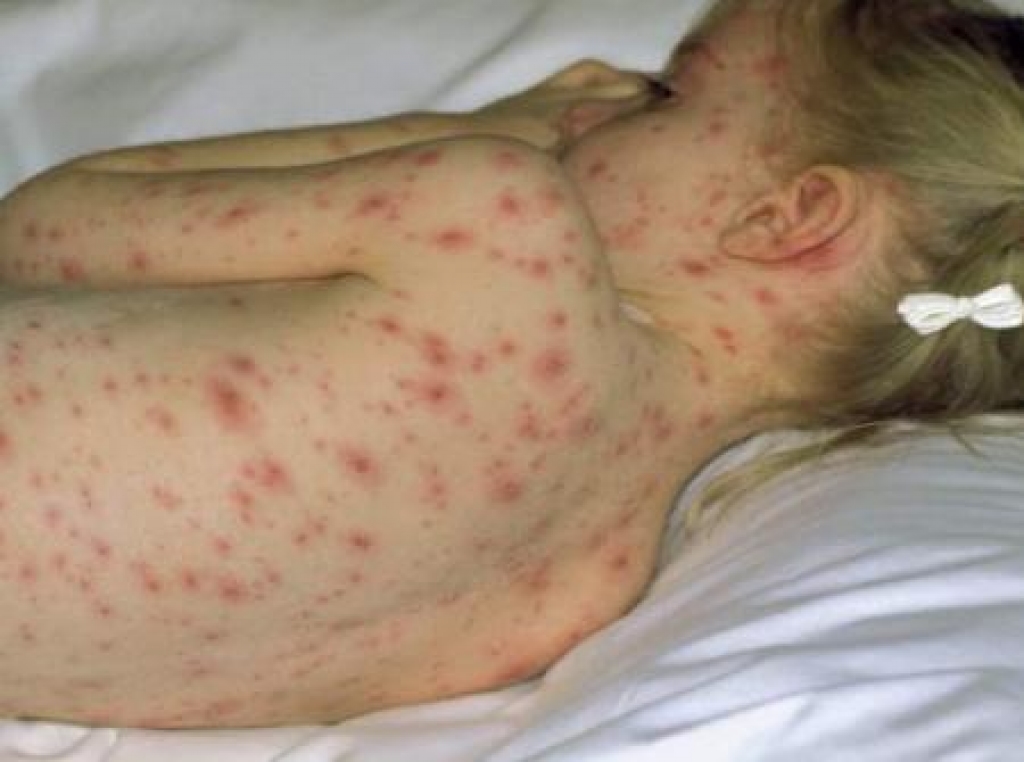 Fotoattēlam ilustratīva nozīme.
Autors: apollo.lv