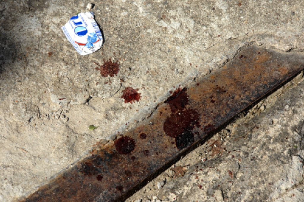 Bauskas mūzikas skolas sētas pusē 17. augusta rītā bija redzamas iepriekšējās nakts jauniešu izdarību pēdas. 
Autors: Ivars Bogdanovs