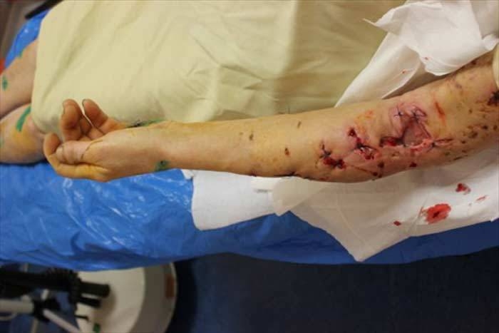 Fotoattēlam ilustratīva nozīme.