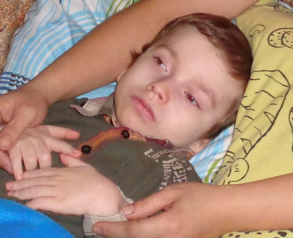 Mazajam Ervīnam Todlebenam ir septiņi gadi. Bet viņš vēl neapmeklē skolu kā citi bērni, viņš neskraida un nerotaļājas. Ervīns ir smagi slims – viņam ir iedzimta centrālās nervu sistēmas patoloģija. Bērns ir gandrīz nekustīgs, un viņu baro tikai caur zondi, kura ir ievadīta kuņģī. Zēnam ir atļauts lietot uzturā tikai speciālo medicīnisko pārtiku. Mēnesī šīs pārtikas iegādei ir vajadzīgi vairāk kā 400 eiro.
Autors: varonis.lv