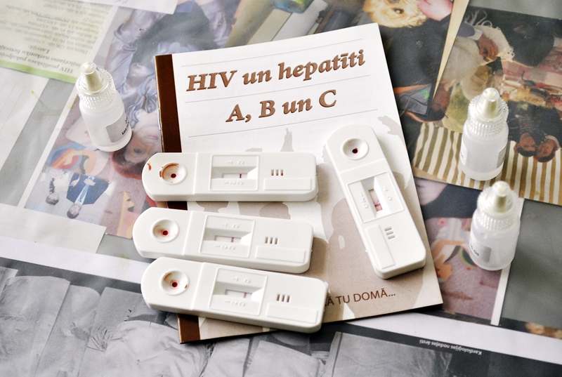 Pozitīvo testa rezultātu īpatsvars mūspusē vērtējams kā gana augsts. SPKC aicina iedzīvotājus, kuriem ir aizdomas par iespējamu inficēšanos, vērsties pie sava ģimenes ārsta, kurš izvērtēs nepieciešamību veikt papildu veselības pārbaudes.
Autors: Ivars Bogdanovs