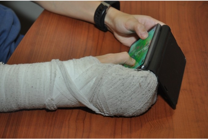 Vispirms noteikti jākonsultējas ar ģimenes ārstu, ja šķiet, ka kauli lūst pārāk viegli. Viņš var nosūtīt pie ortopēda, endokrinologa, ja ir aizdomas par vielmaiņas traucējumiem, vai ģenētiķa, ja iemesls varētu būt iedzimta kaulu problēma.
Autors: Dainis Ģelzis